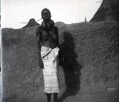 Afrique-Femme atteinte d'un gonflement du cou